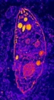 <i>Toxoplasma gondii</i>: Are There any Implications for Routine Blood Screening?